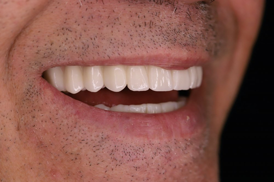 Slider image (6) Dentech Dental Centar